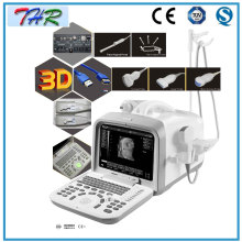 Équipement de diagnostic par ultrasons portable (THR-US6602)